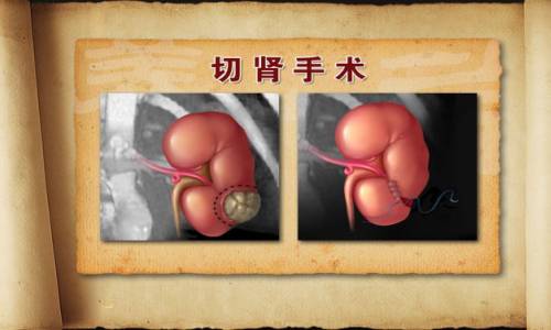 byb.cn byb.cn