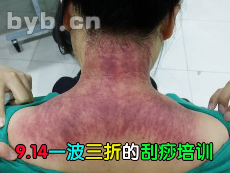 byb.cn 刮痧培訓